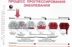 Прогресс от вируса до рака