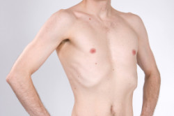 Худоба у мужчины Худоба у мужчины