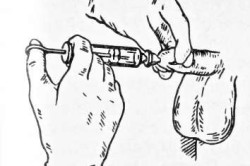 Инстилляция Инстилляция