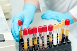 Исследование анализов Исследование анализов