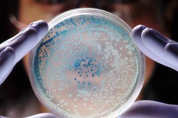 Исследование условно-патогенных микроорганизмов Исследование условно-патогенных микроорганизмов