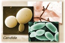 Причиной красных прыщей может быть грибок кандида Причиной красных прыщей может быть грибок кандида