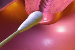 Мазок у мужчин Мазок у мужчин