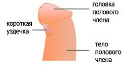 Короткая уздечка как причина преждевременного семяизвержения Короткая уздечка как причина преждевременного семяизвержения