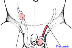 Болезнь и норма