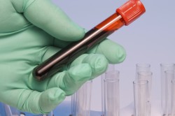 Анализ крови Анализ крови