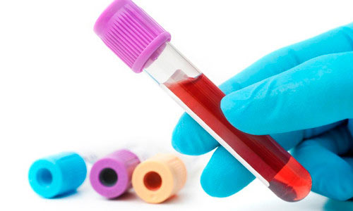 Кровь на анализ Кровь на анализ