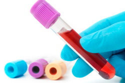 Кровь на анализ Кровь на анализ