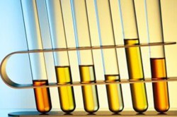 Исследования по цвету мочи Исследования по цвету мочи