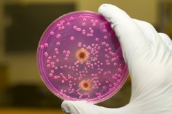 Лабораторная диагностика Лабораторная диагностика