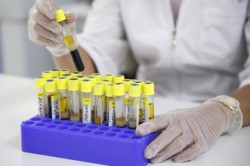 Лабораторное исследование мочи Лабораторное исследование мочи