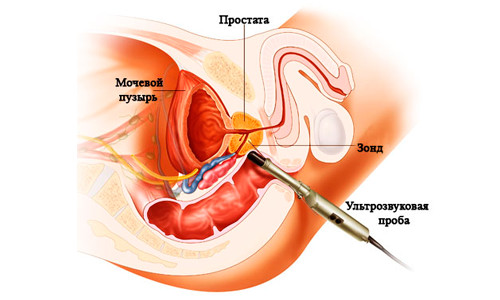 Тыквенные семечки Тыквенные семечки