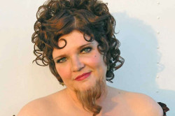 Гиперандрогения у женщины Гиперандрогения у женщины