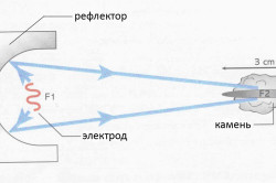Ударно-волновая литотрипсия Ударно-волновая литотрипсия