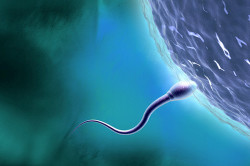 Малоподвижность сперматозоидов Малоподвижность сперматозоидов