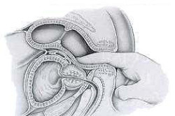 Массаж предстательной железы Массаж предстательной железы