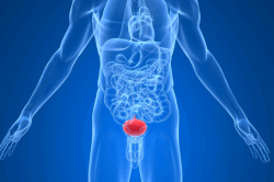 Воспаление мочевого пузыря Воспаление мочевого пузыря