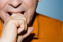 Облысение Облысение