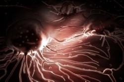 Рисунок 3. Метастазы Рисунок 3. Метастазы