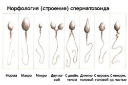 Морфология сперматозоида Морфология сперматозоида