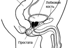 Мужское бесплодие Мужское бесплодие