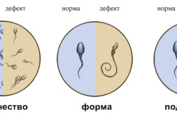 Характеристики спермограммы Характеристики спермограммы