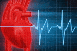 Учащенное сердцебиение Учащенное сердцебиение