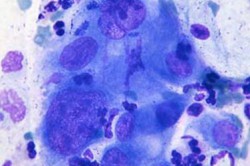 Уриноплазмос Уриноплазмос