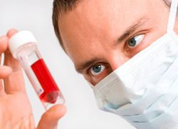 Анализ на лимфоциты Анализ на лимфоциты