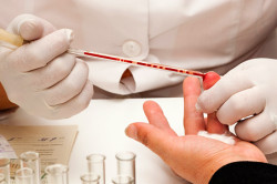 Общий анализ крови Общий анализ крови