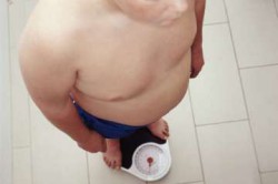 Ожирение Ожирение