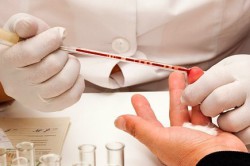 Общие анализы мочи и крови перед операцией Общие анализы мочи и крови перед операцией