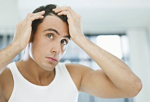 Признаки облысения Признаки облысения