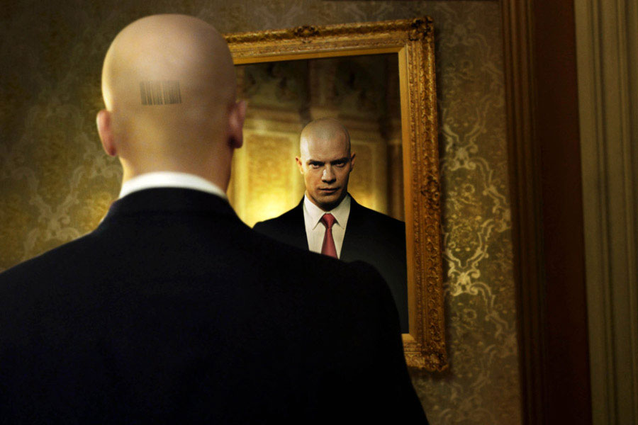 Полное облысение у мужчины