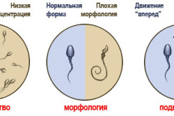 Морфология сперматозоидов Морфология сперматозоидов