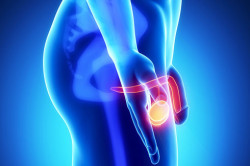 Орхит Орхит