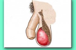 Орхит Орхит