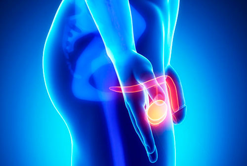 Воспаление яичек у мужчины Воспаление яичек у мужчины