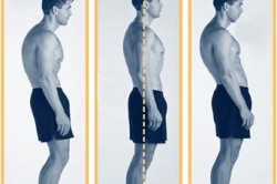 Неправильная осанка Неправильная осанка