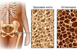 Норма и болезнь Норма и болезнь