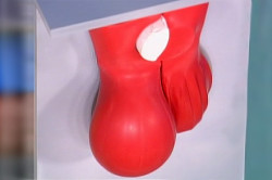 Отек яичка в качестве причины боли Отек яичка в качестве причины боли