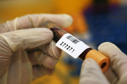 Тест на ПСА Тест на ПСА