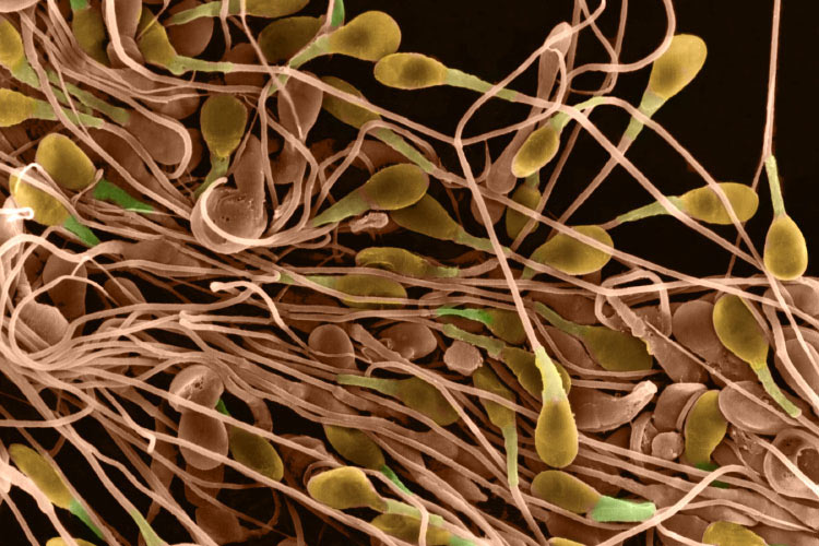 Переизбыток сперматозоидов Переизбыток сперматозоидов