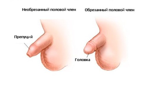 Обрезанный и необрезанный пенис Обрезанный и необрезанный пенис