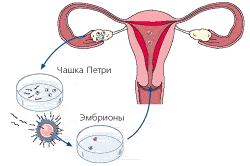 Процедура эко Процедура эко