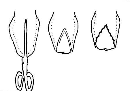Операция по продольному рассечению Операция по продольному рассечению
