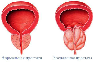 Проблемы с потенцией Проблемы с потенцией