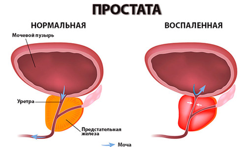Строение органов малого таза мужчины Строение органов малого таза мужчины