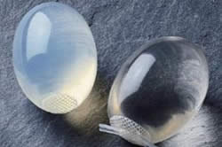 Протезирование Протезирование