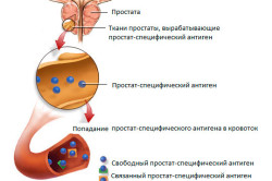 Простатический специфический антиген Простатический специфический антиген